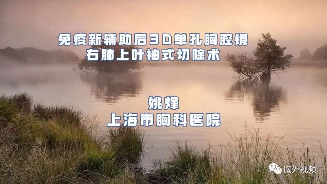 免疫新辅助后3D单孔胸腔镜右肺上叶袖式切除术 （有解说）姚烽-外科技术网
