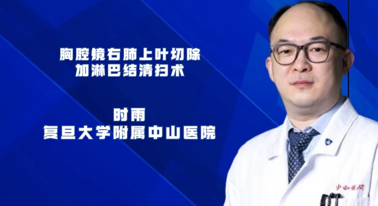 胸腔镜右肺上叶切除+淋巴结清扫术  时雨-外科技术网