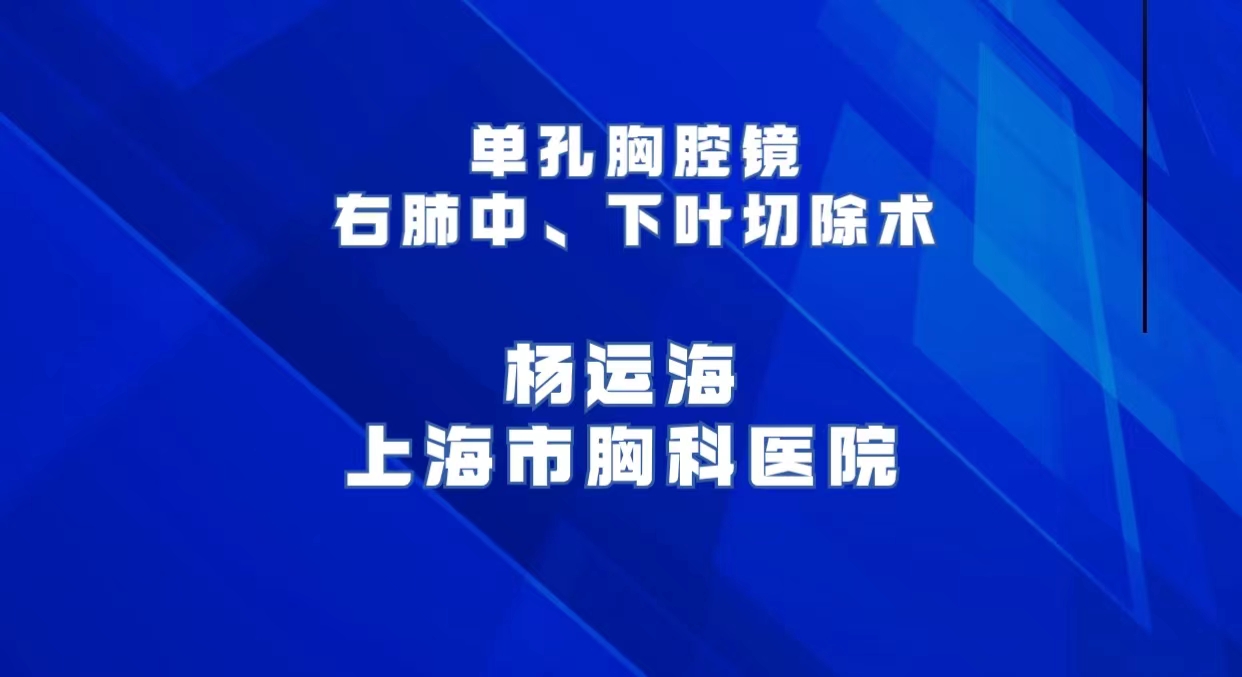 单孔胸腔镜右肺中、下叶切除术 杨运海-外科技术网