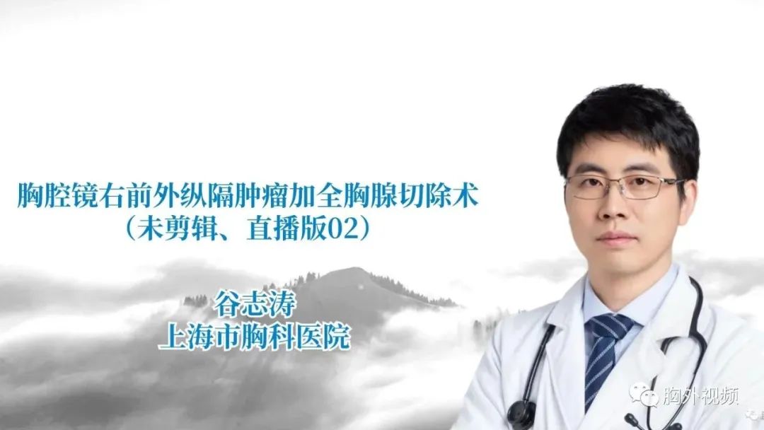胸腔镜右前外纵隔肿瘤+全胸腺切除术（未剪辑、直播版2）谷志涛-外科技术网