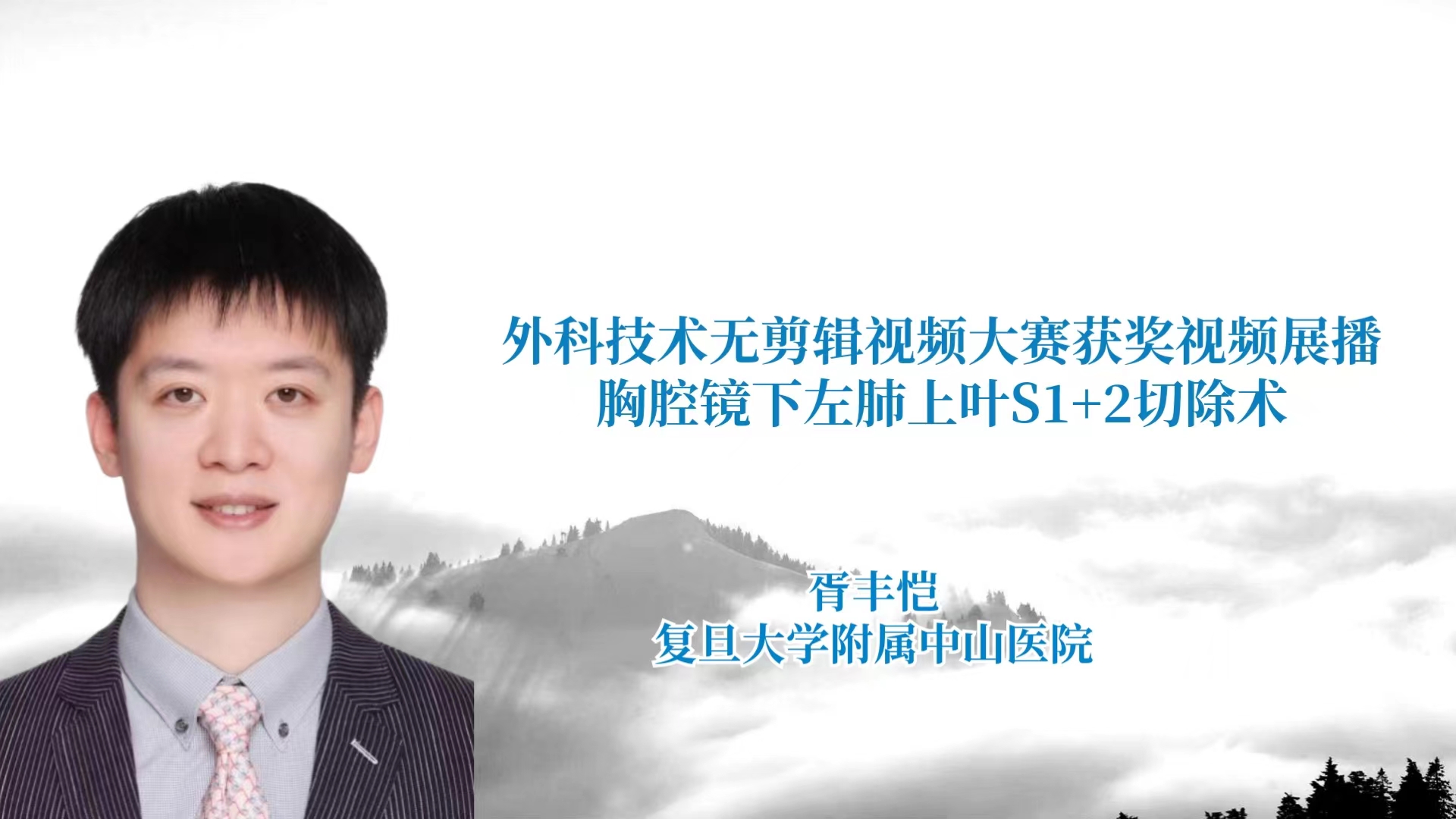 胥丰恺  胸腔镜左肺上叶S1+2切除术