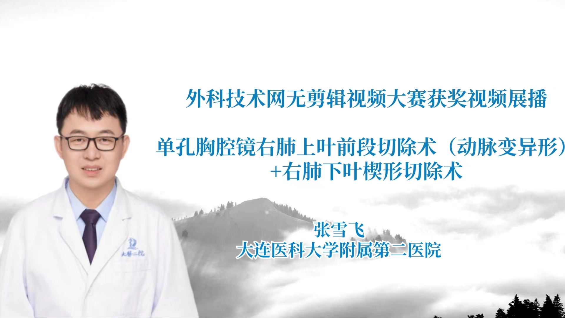 胥丰恺  胸腔镜左肺上叶S1+2切除术