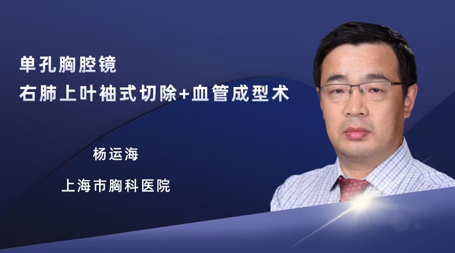 杨运海  单孔胸腔镜右肺上叶袖式切除+血管成型术（135分钟)