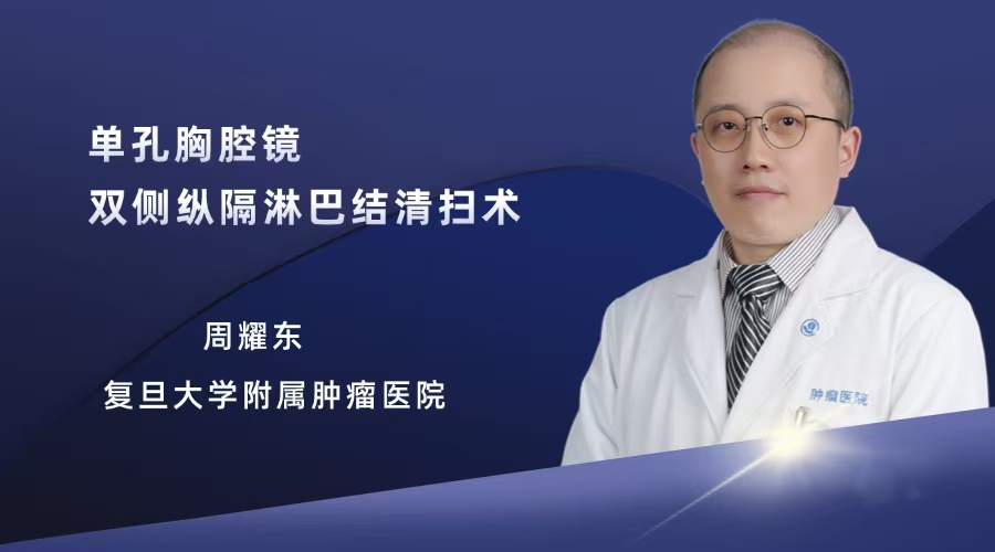 周耀东 单孔胸腔镜双侧纵隔淋巴结清扫术