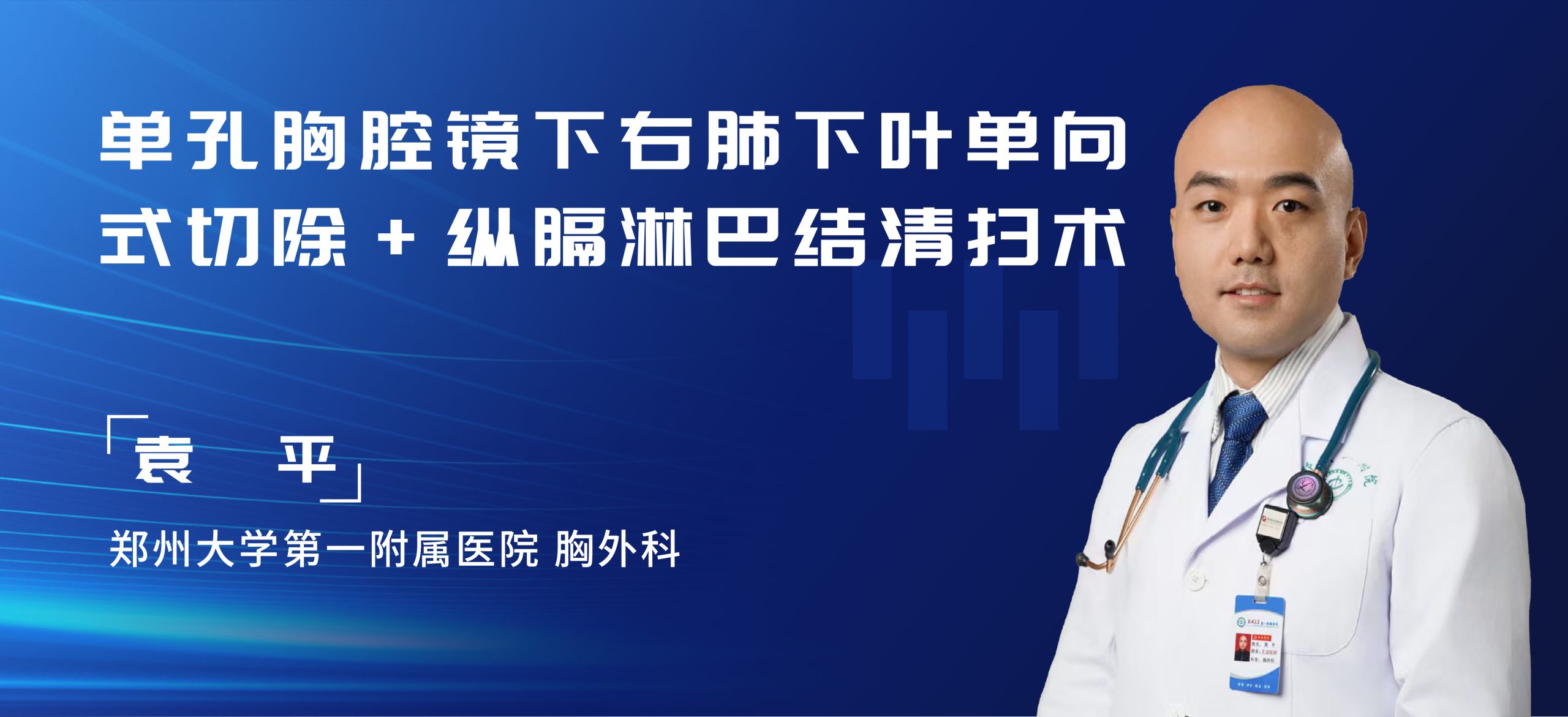 袁平 单孔胸腔镜下右肺下叶单向式切除+纵膈淋巴结清扫术