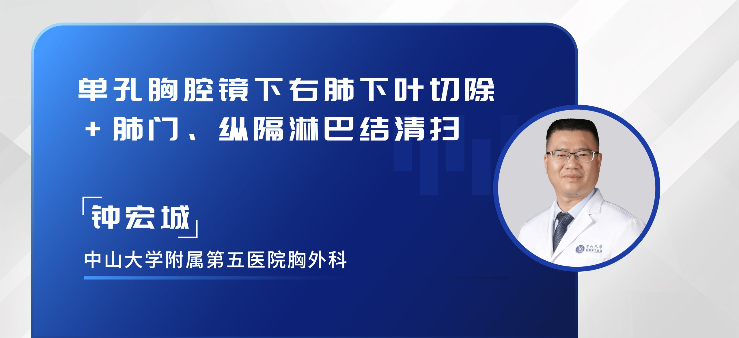 钟宏城 单孔胸腔镜下右肺下叶切除+肺门、纵隔淋巴结清扫
