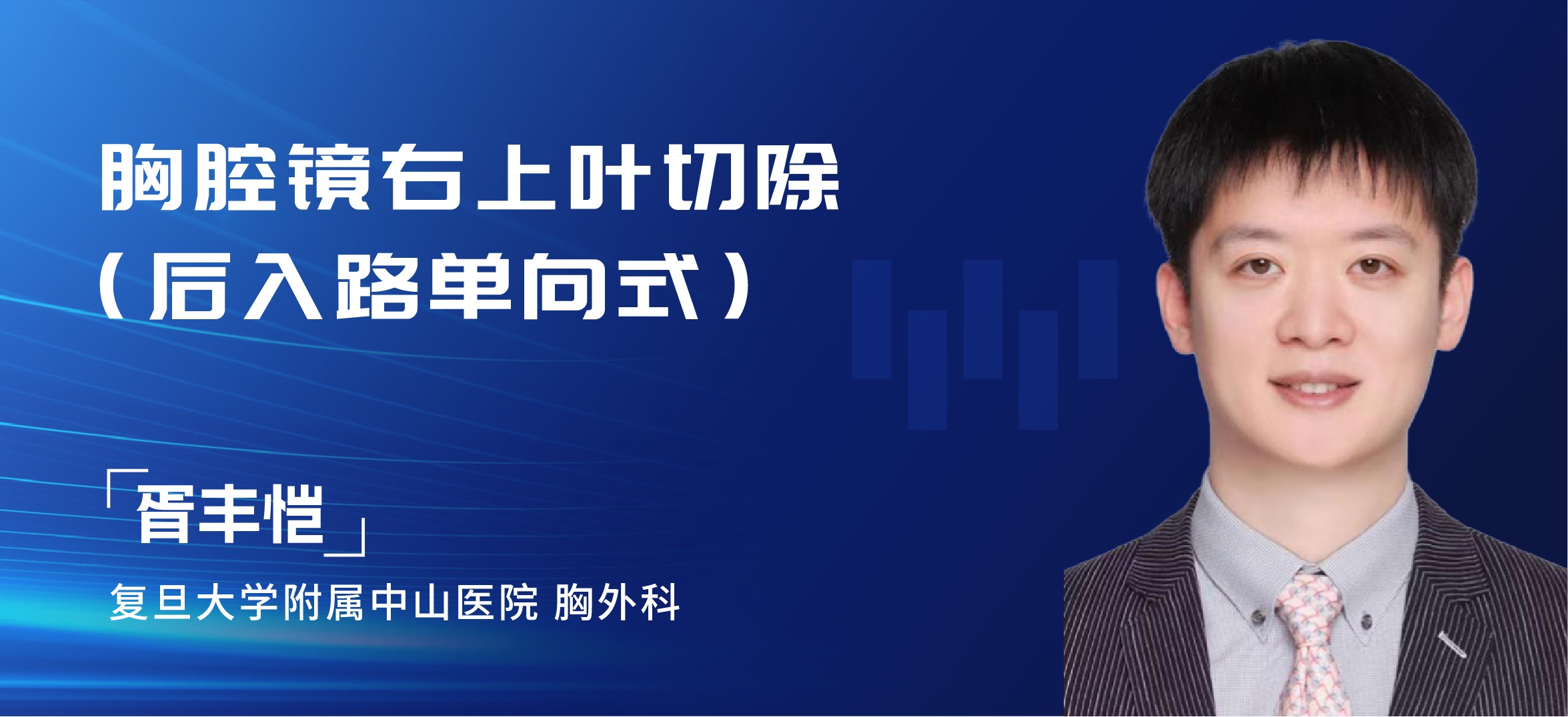 胥丰恺  胸腔镜右上叶切除（后入路单向式）
