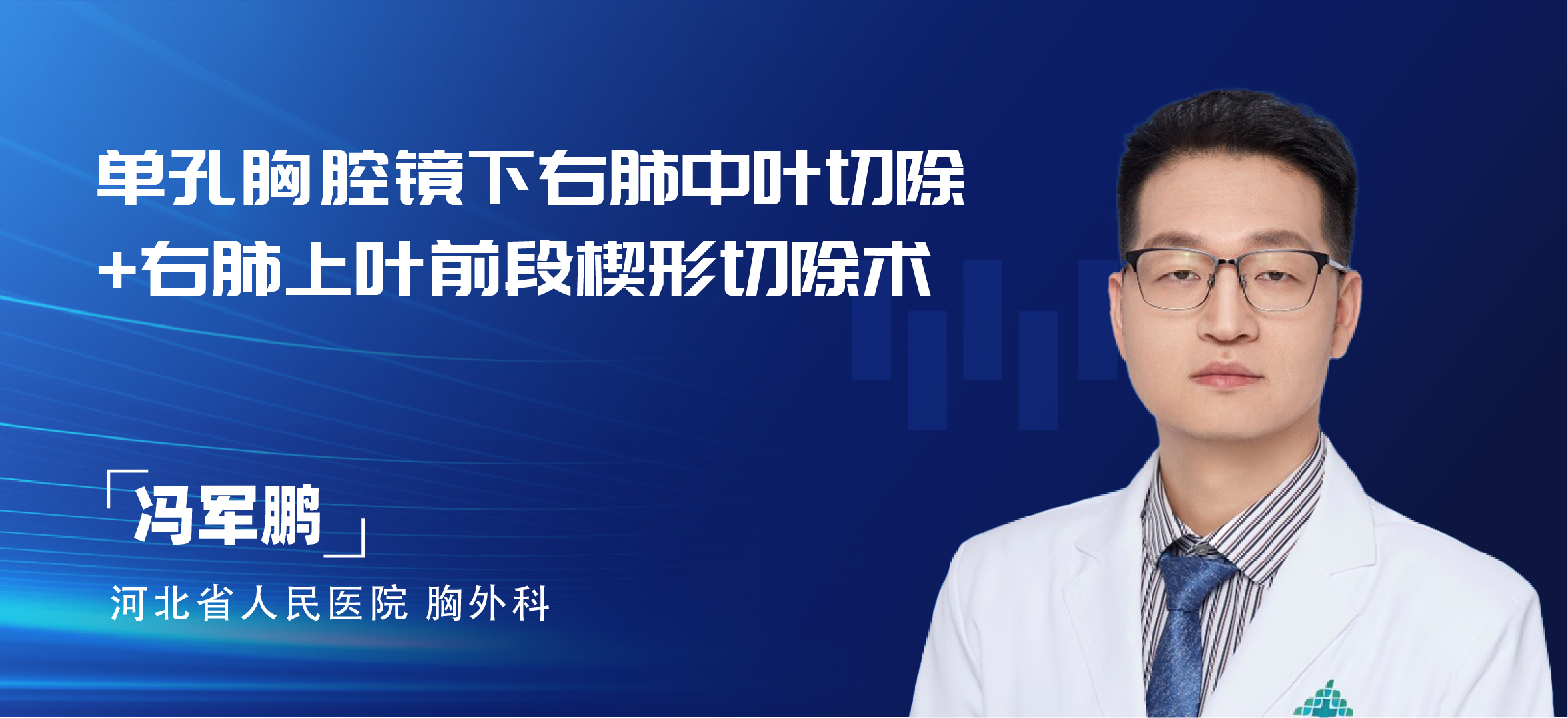冯军鹏 单孔胸腔镜下右肺中叶切除+右肺上叶前段楔形切除术