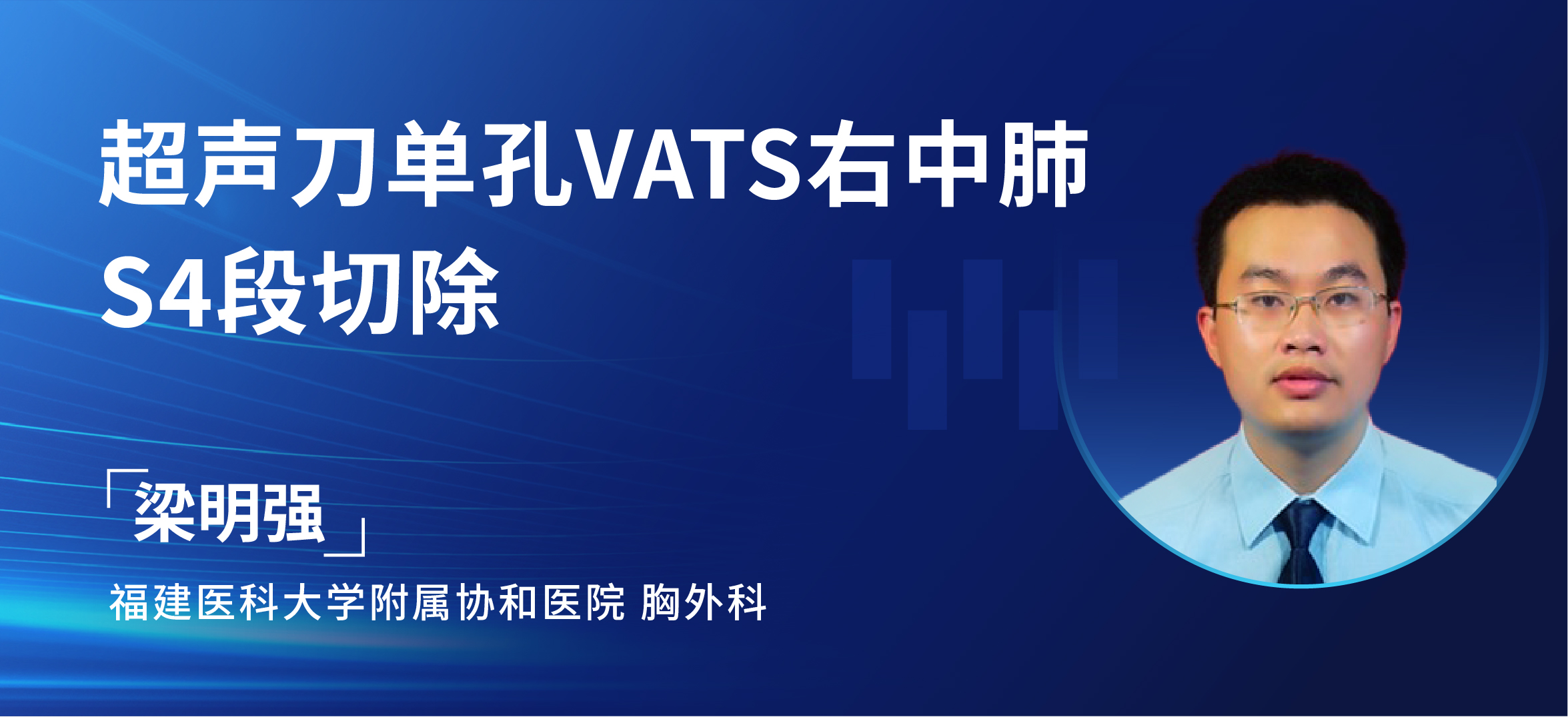 梁明强  超声刀单孔VATS右中肺S4段切除