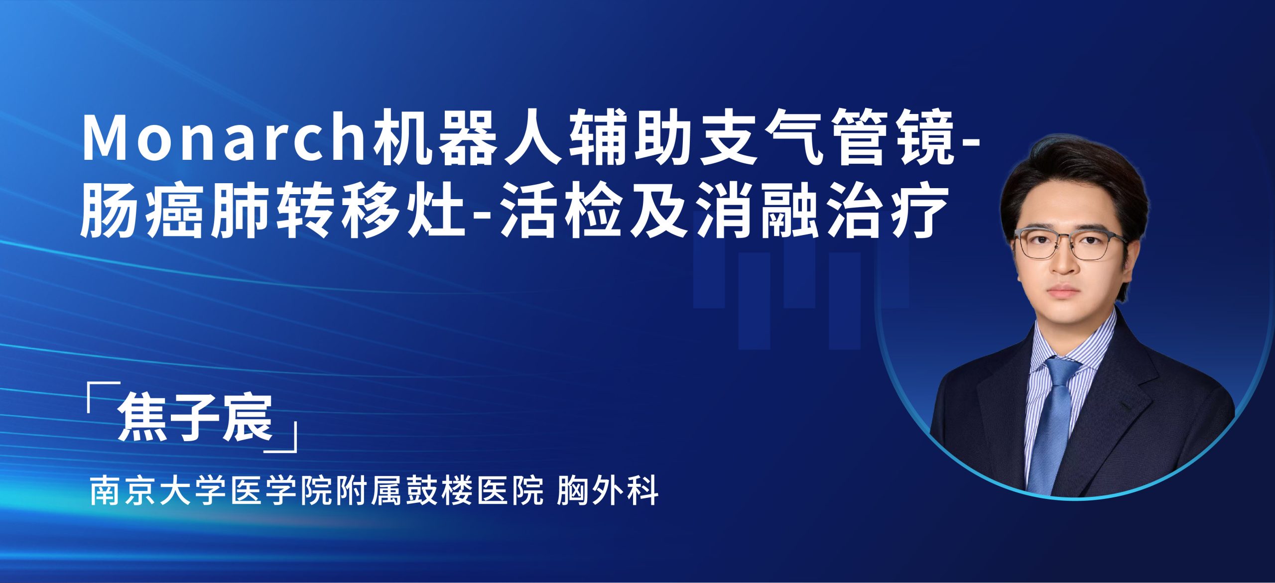 焦子宸 Monarch机器人辅助支气管镜-肠癌肺转移灶-活检及消融治疗-外科技术网