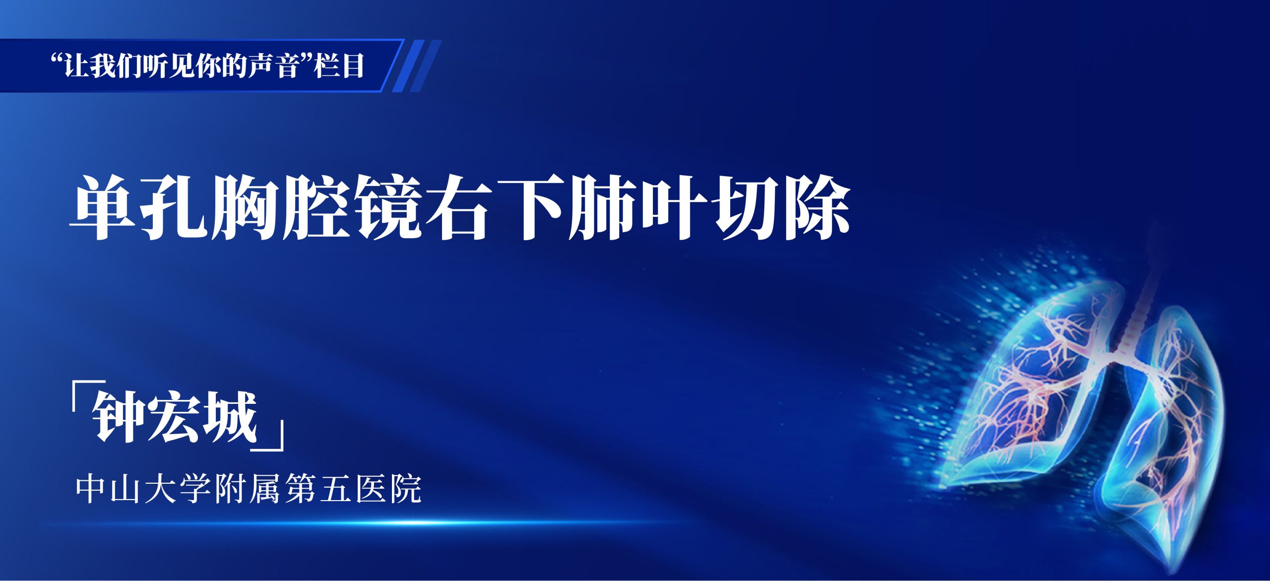 钟宏城 单孔胸腔镜右下肺叶切除-外科技术网