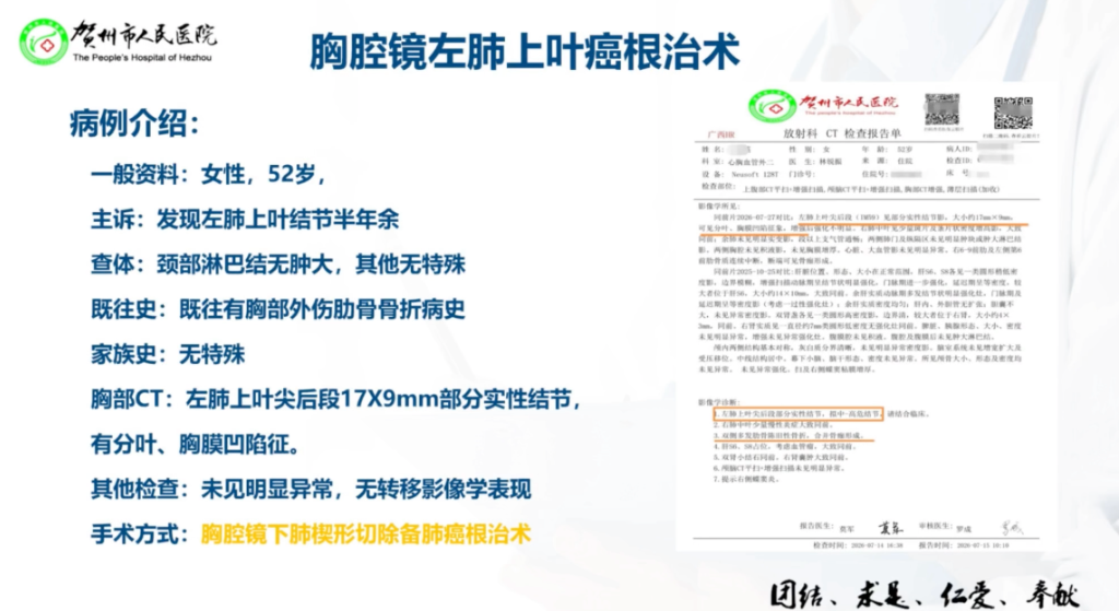 图片[1]-肖邦友 胸腔镜左肺上叶癌根治术
