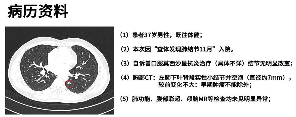 图片[1]-宁鲁 左肺下叶背段切除